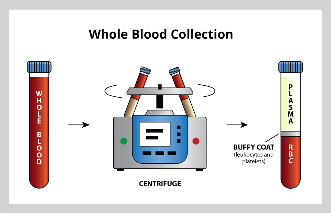 FAQ Series What is the difference between Buffy Coat and Leukapheresis